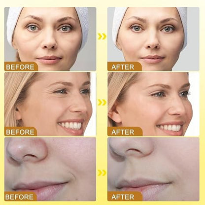 **OUHOE Bee Venom Wrinkle Cream – Anti-Aging Face Moisturizer for Fine Lines & Smooth-Looking Skin**