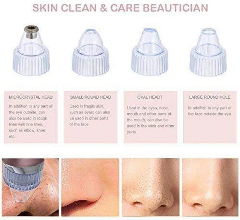 **Pore Cleaning Device – Electric Facial Pore Cleaner for Blackhead & Deep Skin Cleaning**
