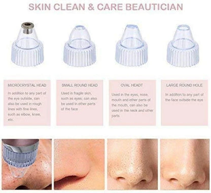 **Pore Cleaning Device – Electric Facial Pore Cleaner for Blackhead & Deep Skin Cleaning**
