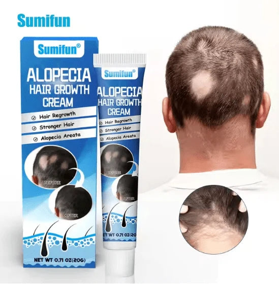 **Sumifun Hair Growth Cream 40ml – 2 Pack (20ml + 20ml) Herbal Scalp Care Cream**