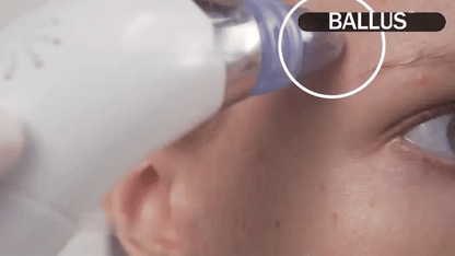**Pore Cleaning Device – Electric Facial Pore Cleaner for Blackhead & Deep Skin Cleaning**